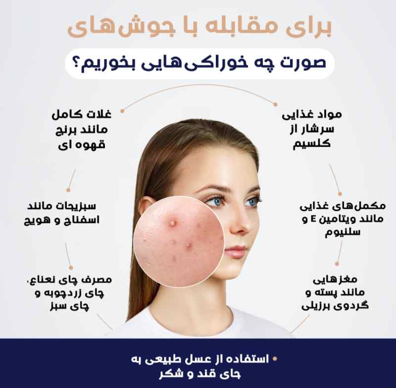 رژیم غذایی برای درمان جوش‌های صورت