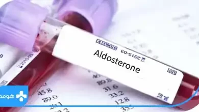 تشخیص مشکلات فشارخون با آزمایش aldosterone