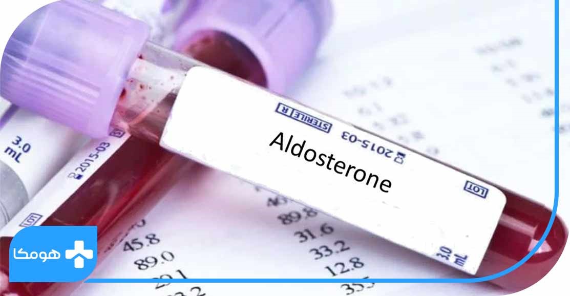 تشخیص مشکلات فشارخون با آزمایش aldosterone